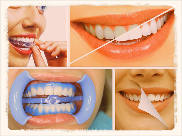 Как можно отбелить зубы в домашних условиях. Отбеливание зубов в домашних. Отбелить зубы в домашних условиях. Домашнее отбеливание зубов. Отбеливание зубов домашнее отбеливание.